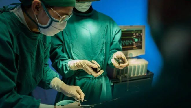 Beyninden 8 santimetrelik canlı solucan çıkarıldı!