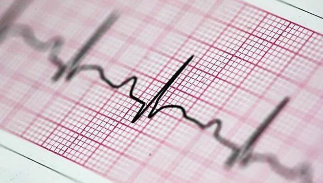Bilim insanlarından düzensiz kalp atışını tespit eden kulaklık: 2 yıl içinde EKG’nin yerini alabilir